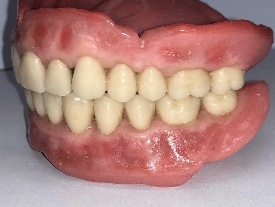 Appareil-dentaire